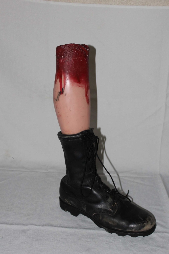 Severed Leg